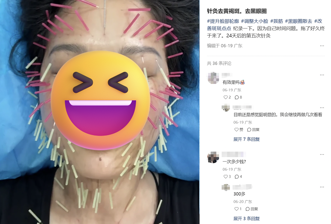 云南白药湿敷黑眼圈替代海蓝之谜？不想被贵妇眼霜收割的熬夜打工人，都在玩“邪修”（组图） - 10