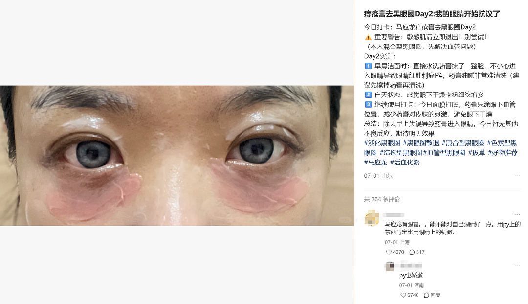 云南白药湿敷黑眼圈替代海蓝之谜？不想被贵妇眼霜收割的熬夜打工人，都在玩“邪修”（组图） - 9