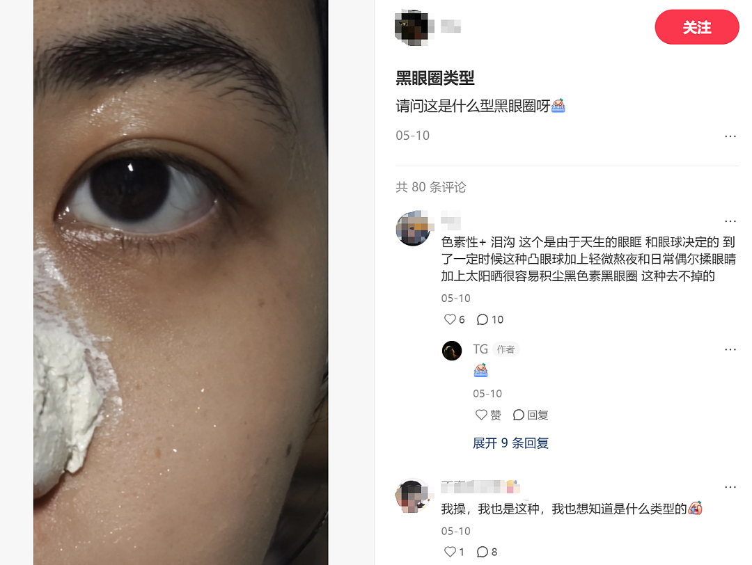 云南白药湿敷黑眼圈替代海蓝之谜？不想被贵妇眼霜收割的熬夜打工人，都在玩“邪修”（组图） - 20