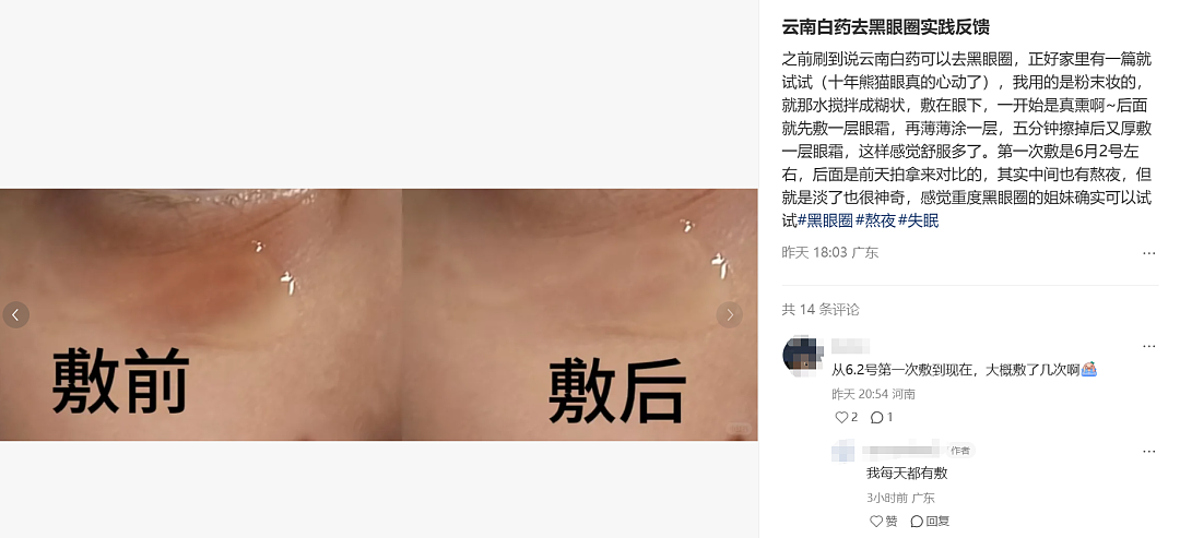 云南白药湿敷黑眼圈替代海蓝之谜？不想被贵妇眼霜收割的熬夜打工人，都在玩“邪修”（组图） - 4