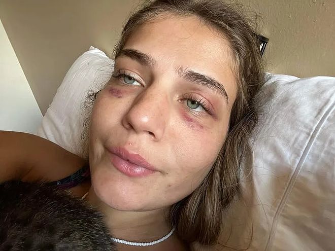 29岁巴西女模遭球员男友虐待，被绑楼梯上殴打，有证据却难获帮助（组图） - 4