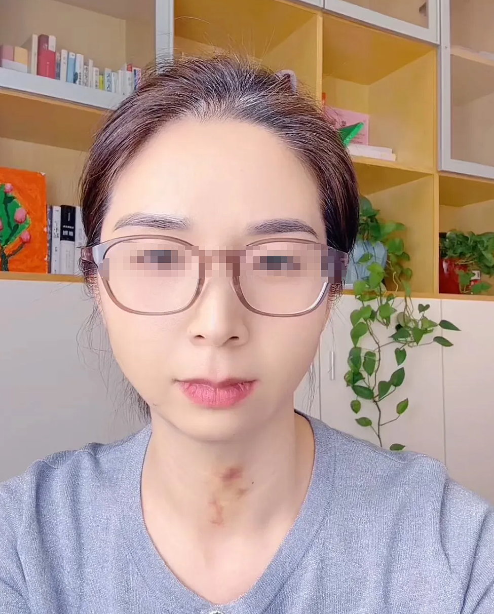 女总监和男领导出差酒醒后下体剧痛，对方否认性侵但一段录音真相了（视频/组图） - 1