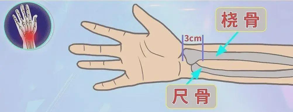 22岁小伙摔倒以为没事，7天后死亡！千万警惕这些信号（组图） - 2