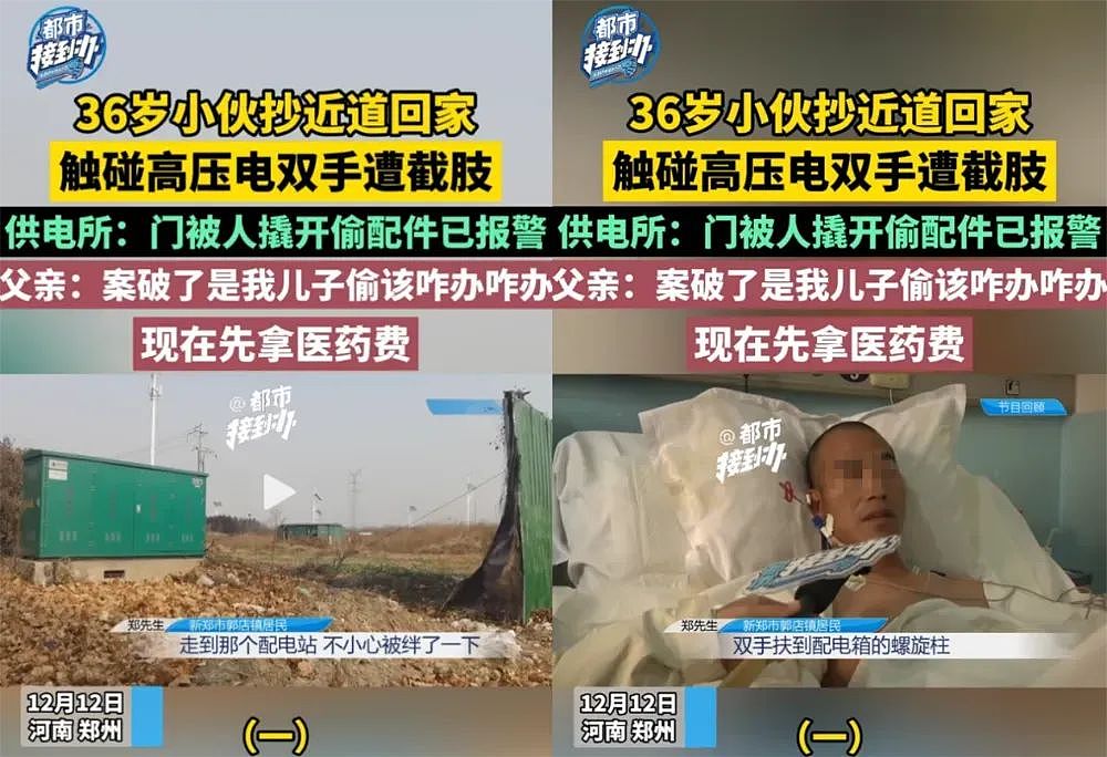 河南断臂男被电炸的离奇经历,多少掺点玄学命理…(组图) - 6