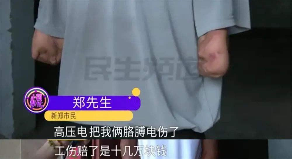 河南断臂男被电炸的离奇经历,多少掺点玄学命理…(组图) - 4