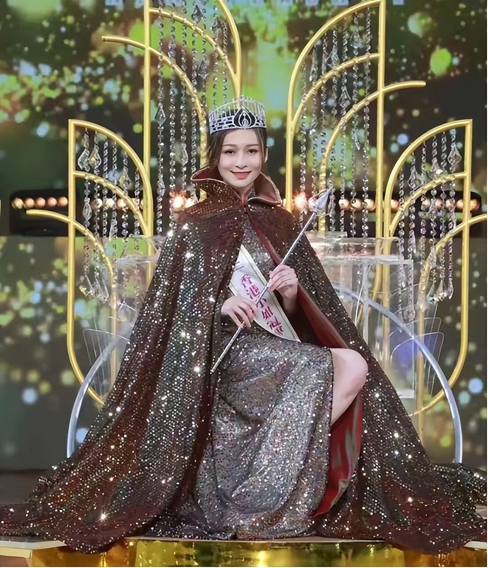 TVB星二代被传父女恋后事业崩盘，自曝拉断髀筋，导致出血好恐怖（组图） - 1