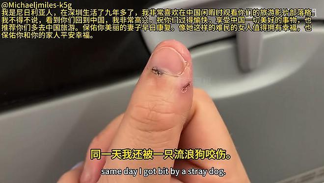 只认中国!英国夫妇游巴厘岛被狗咬,飞中国打疫苗,自家人都不信(组图) - 4