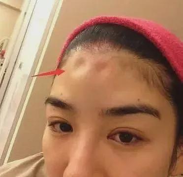 知名女星宣布出轨？！下嫁渣男孕期被打毁容，复出后走哪都被欺负？（组图） - 10