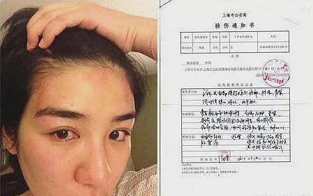 知名女星宣布出轨？！下嫁渣男孕期被打毁容，复出后走哪都被欺负？（组图） - 11