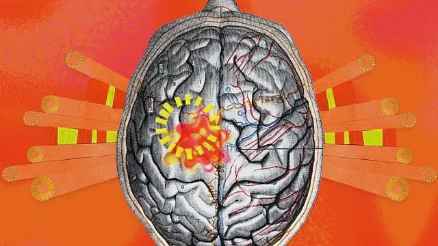 世界正变得愈来愈热,这如何影响我们的大脑(组图) - 1