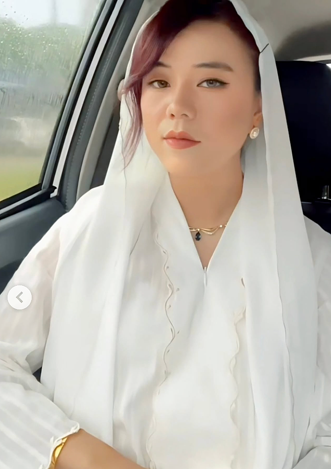 妹纸怀孕前青春靓丽，怀孕后直接毁容，鼻子变大全脸长疮发炎，看起来老了几十岁？（组图） - 2