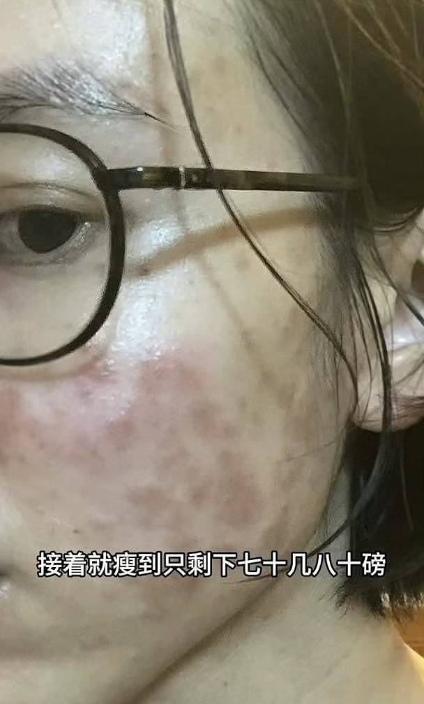 TVB前女星转行直播带货!自曝患病身上没一块好肉(组图) - 4