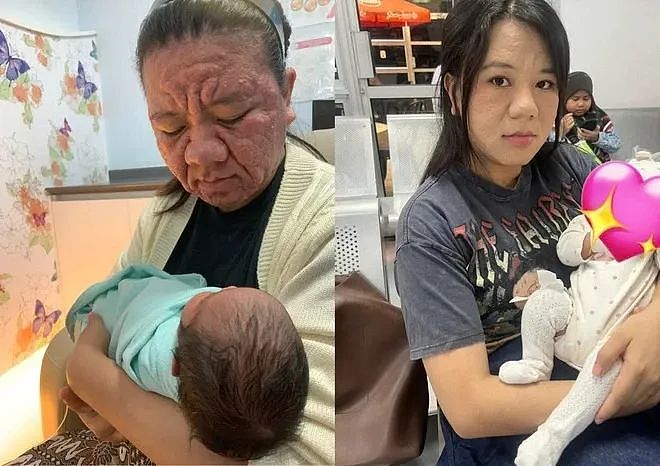 妹纸怀孕前青春靓丽，怀孕后直接毁容，鼻子变大全脸长疮发炎，看起来老了几十岁？（组图） - 10
