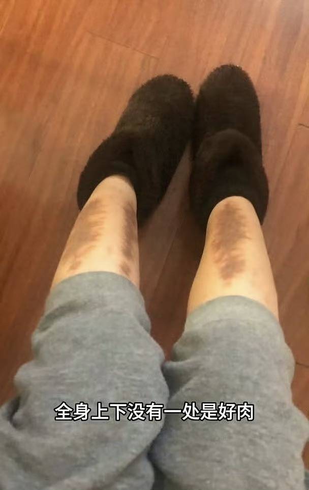 TVB前女星转行直播带货!自曝患病身上没一块好肉(组图) - 5