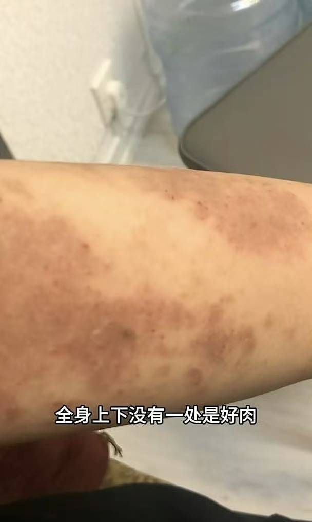 TVB前女星转行直播带货!自曝患病身上没一块好肉(组图) - 6