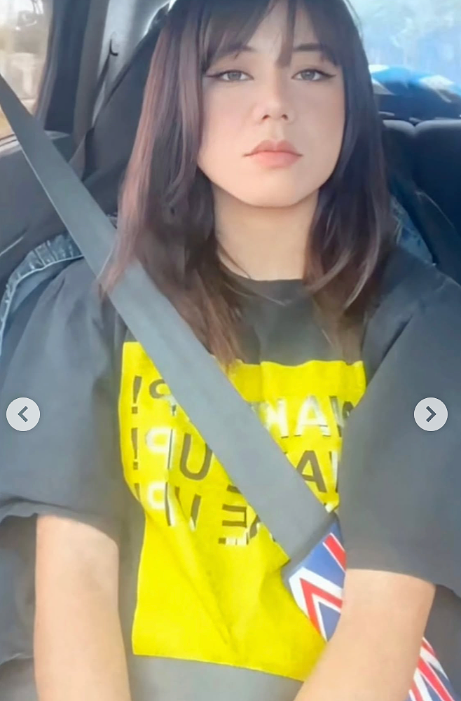 妹纸怀孕前青春靓丽，怀孕后直接毁容，鼻子变大全脸长疮发炎，看起来老了几十岁？（组图） - 3