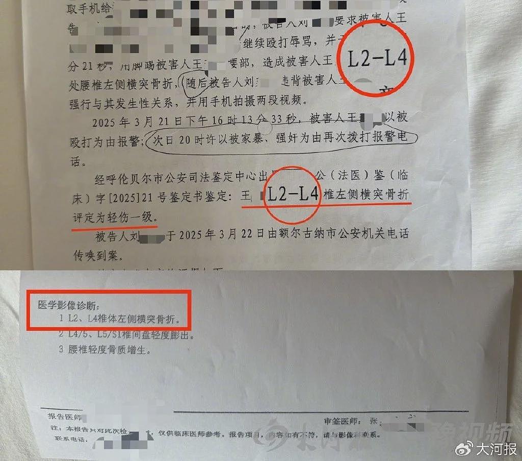 “婚内强奸案”庭审曝光：男方提出重做伤情鉴定（组图） - 2