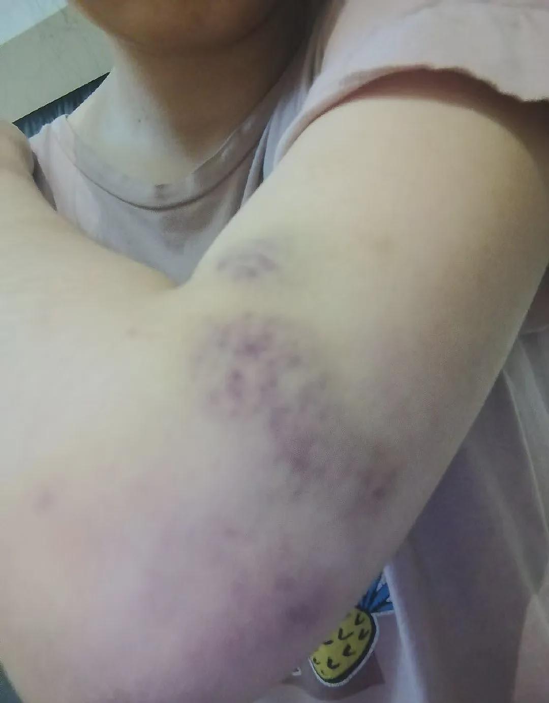 中国美女自掏40 万下嫁阿拉伯男，结婚5个月被打4次、连扇20个耳光（组图） - 30
