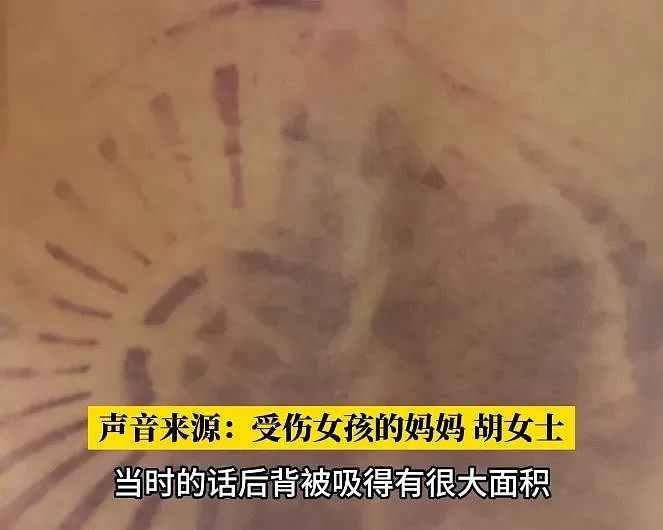 6岁女孩酒店水池殒命！左腿被水管卡住，4个大人救不出，妈妈眼睁睁看娃溺水却无能为力，网友愤怒（组图） - 14