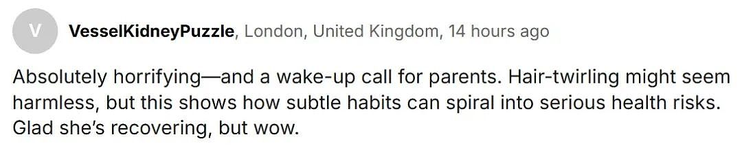 女孩长期腹痛，竟在胃里发现西瓜大头发球？！梦中吃头发，自己不知道...（组图） - 3