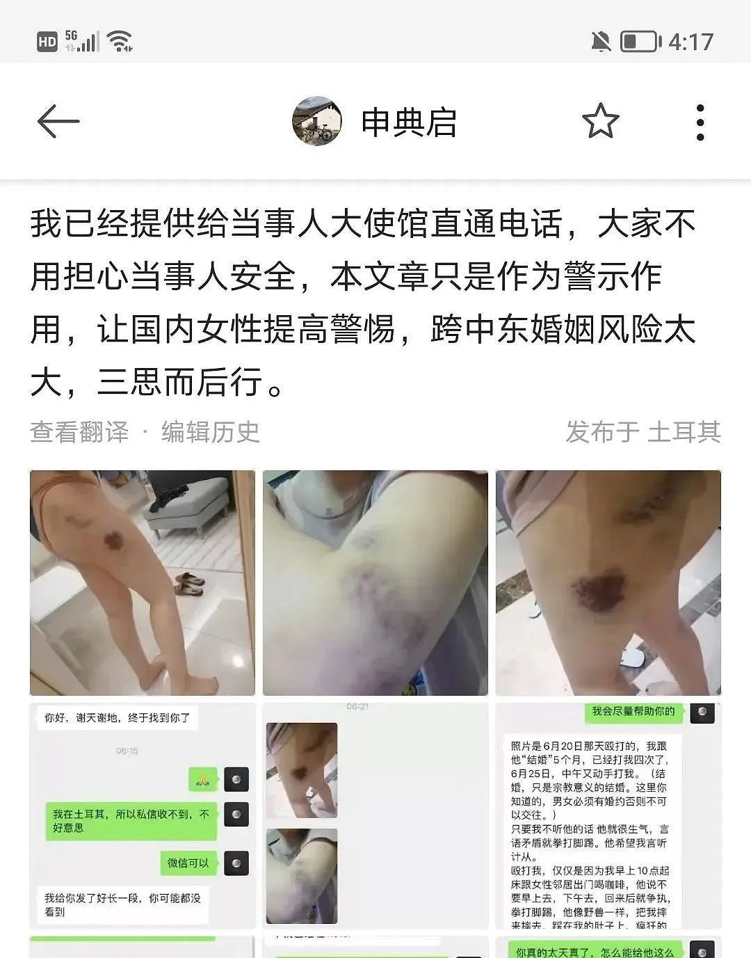 中国美女自掏40 万下嫁阿拉伯男，结婚5个月被打4次、连扇20个耳光（组图） - 28