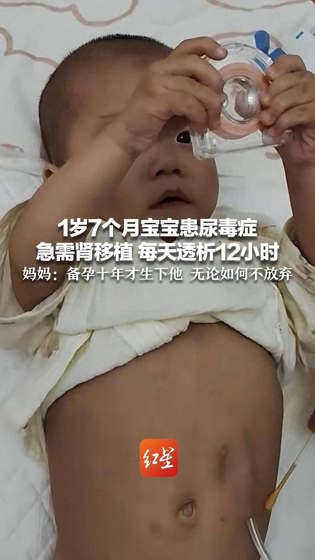 女子备孕10年生下宝宝患尿毒症,每天透析12小时(图) - 1