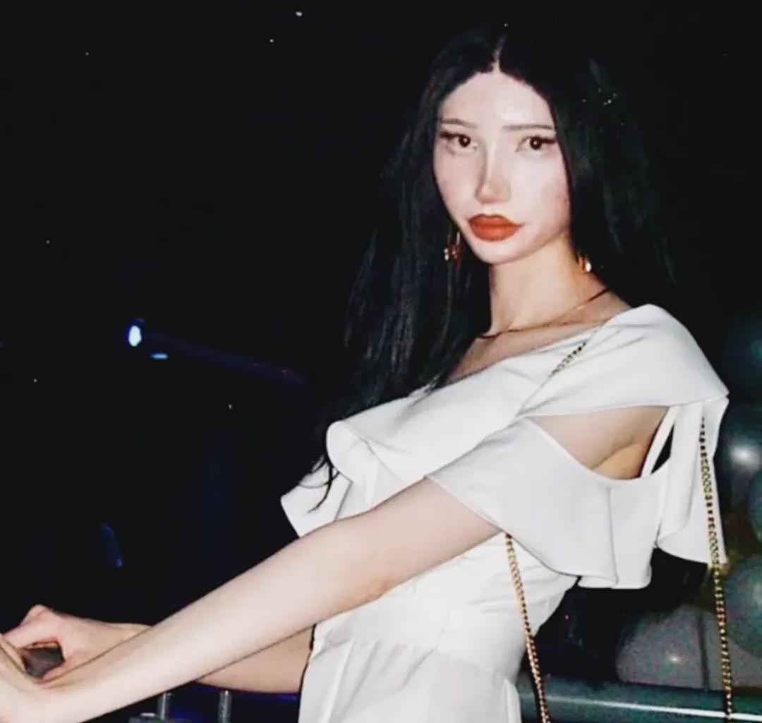 白女疯狂整容,只为成为韩国美女!全脸爆改整成塑料人,网友:有点渗人啊…(组图) - 5