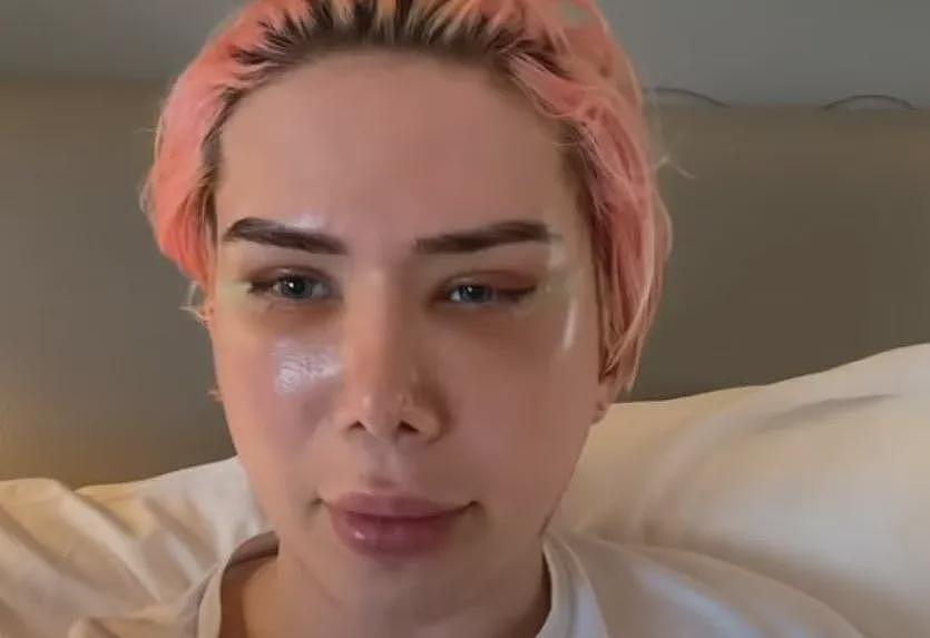 白女疯狂整容,只为成为韩国美女!全脸爆改整成塑料人,网友:有点渗人啊…(组图) - 13