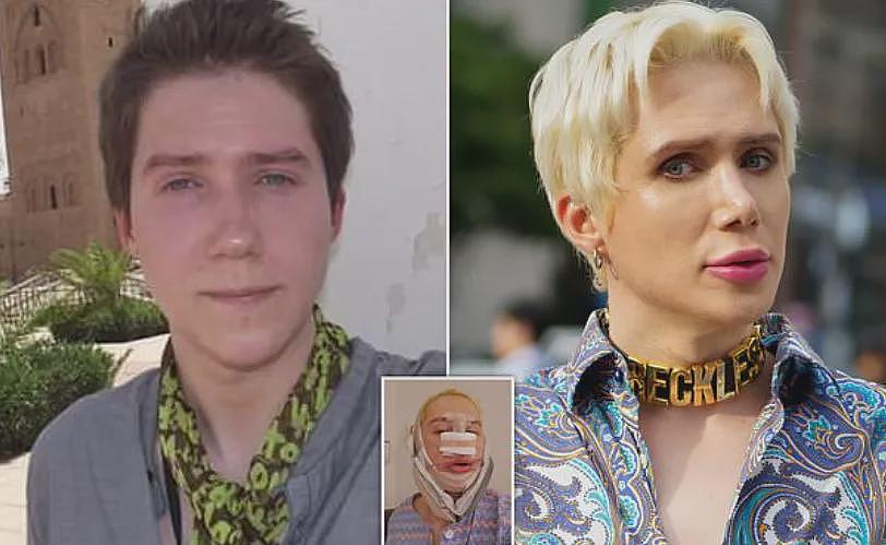 白女疯狂整容,只为成为韩国美女!全脸爆改整成塑料人,网友:有点渗人啊…(组图) - 14