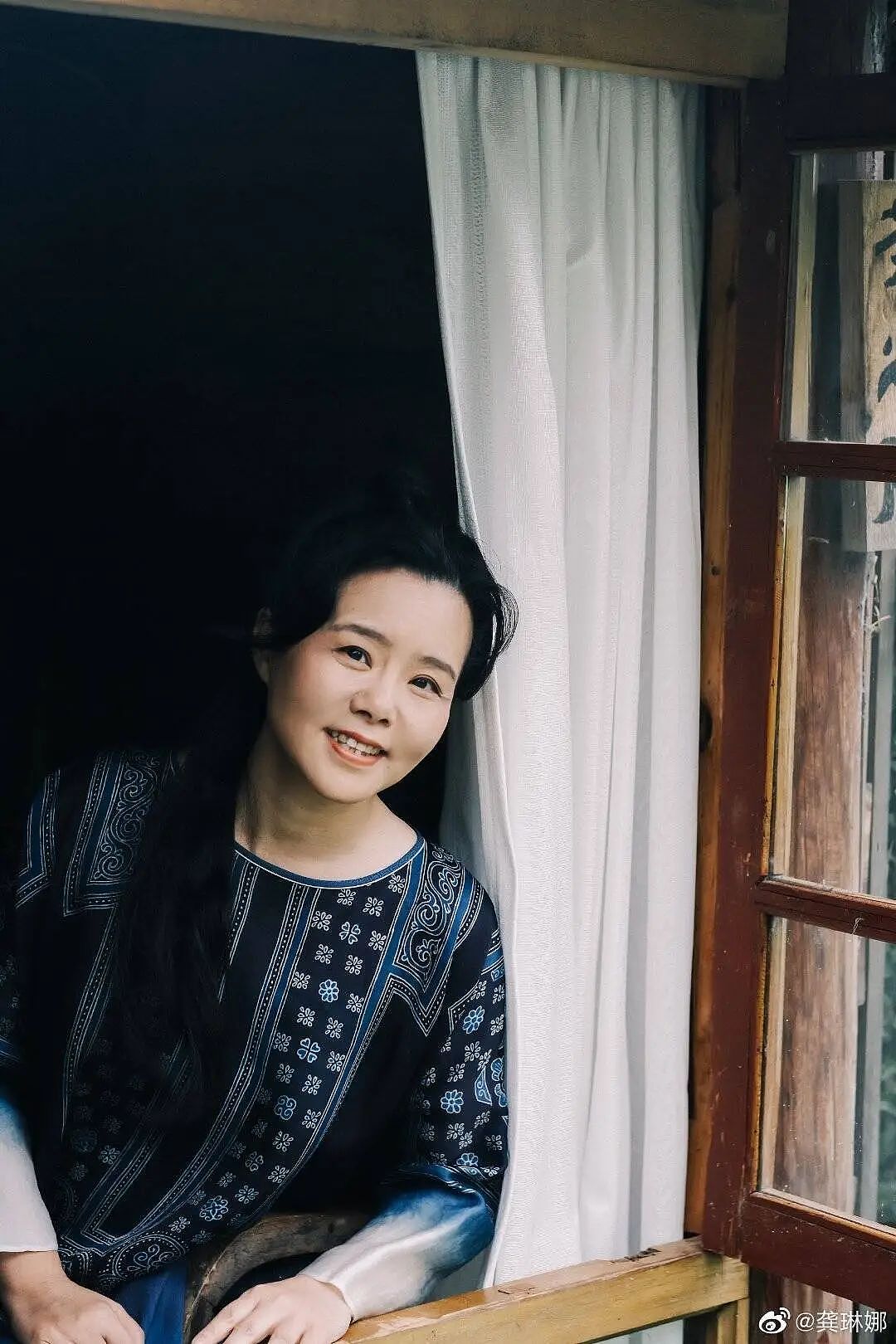 50岁龚琳娜自曝曾“几乎瘫痪”，因严重的腰椎间盘突出无法走路（组图） - 1