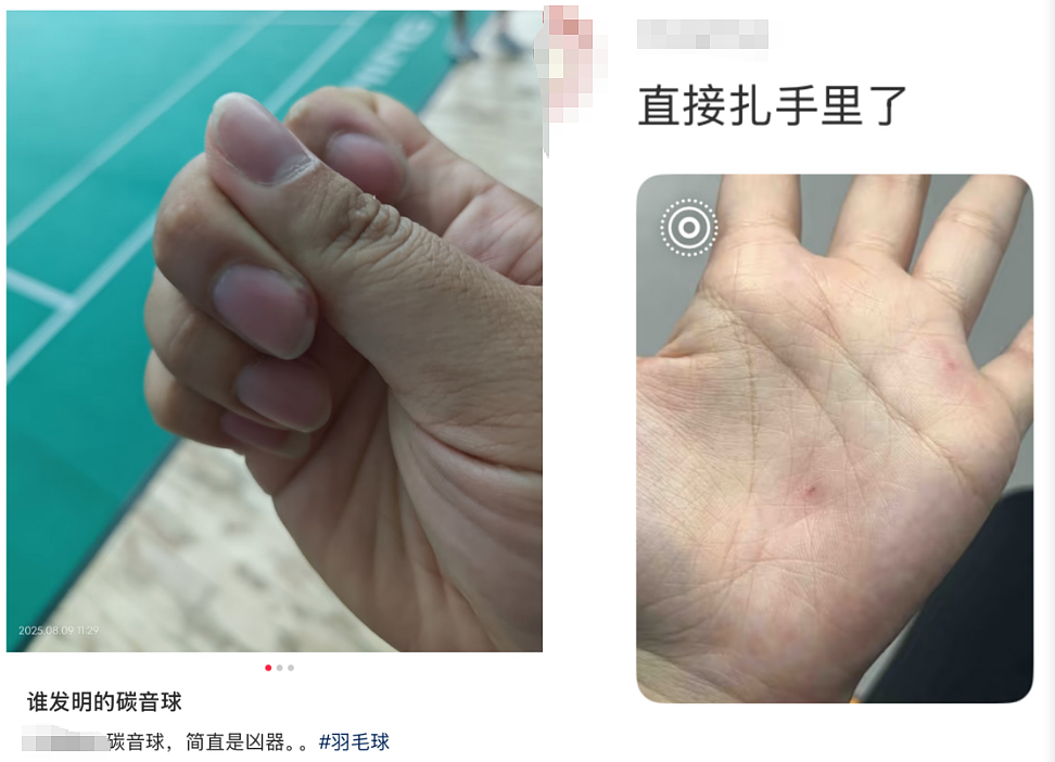 真没想到“杀伤力”如此惊人！击穿眉骨、扎穿手指...已有多人受伤！近期人气飙升（组图） - 21