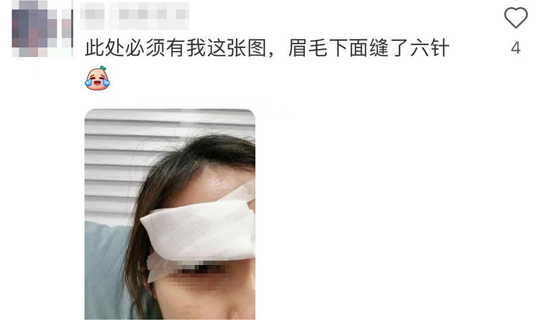 真没想到“杀伤力”如此惊人！击穿眉骨、扎穿手指...已有多人受伤！近期人气飙升（组图） - 7