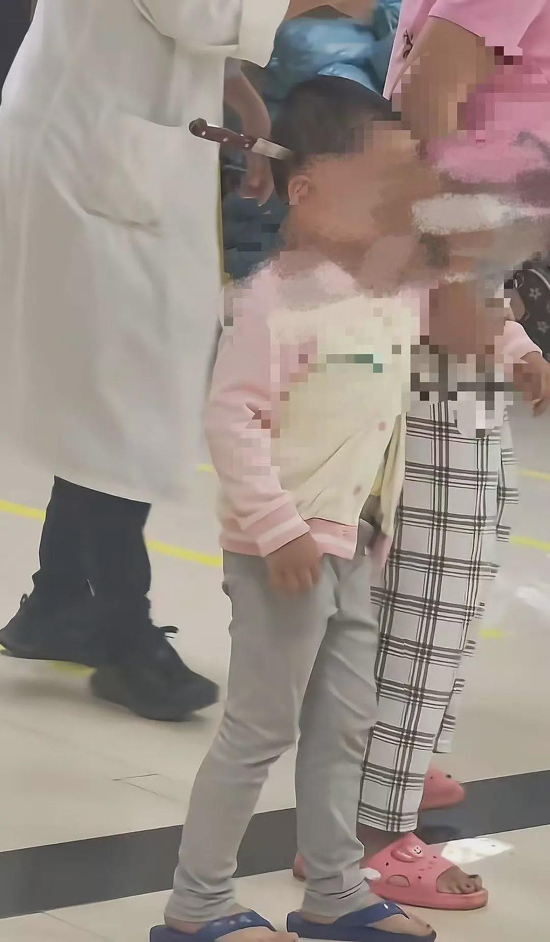 3岁女童头上插刀淡定就医,医院:已做开颅手术,成功取刀,身体情况稳定(视频/组图) - 2