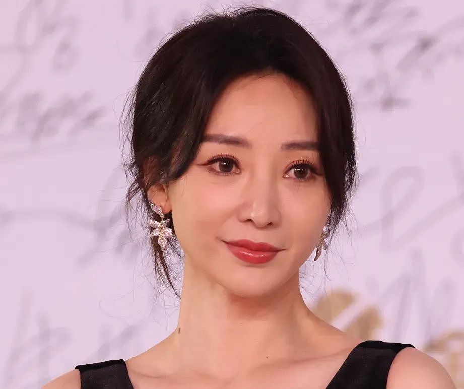 越来越多女星承认整容！有人后悔有人上瘾，动了28次手术停不下来（组图） - 5