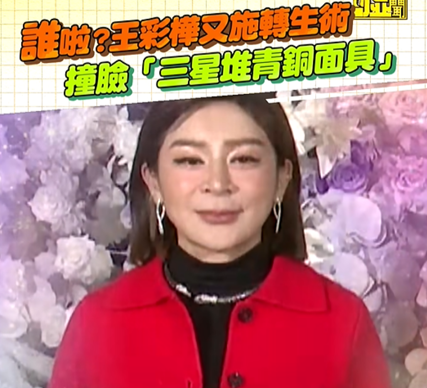 越来越多女星承认整容！有人后悔有人上瘾，动了28次手术停不下来（组图） - 10