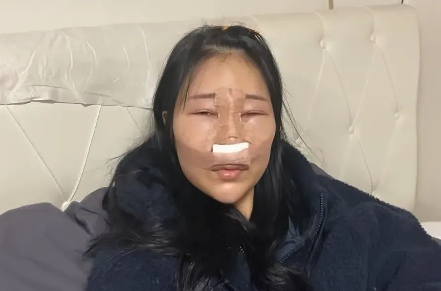 越来越多女星承认整容！有人后悔有人上瘾，动了28次手术停不下来（组图） - 22
