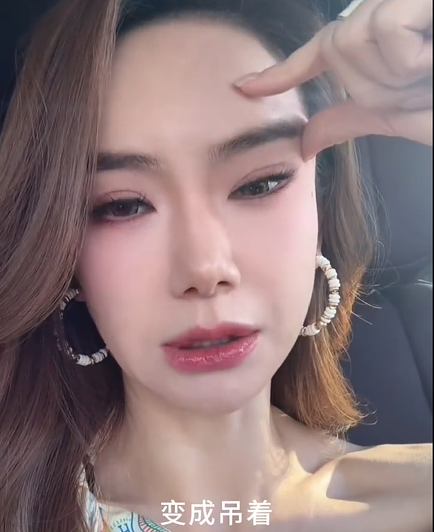 越来越多女星承认整容！有人后悔有人上瘾，动了28次手术停不下来（组图） - 25