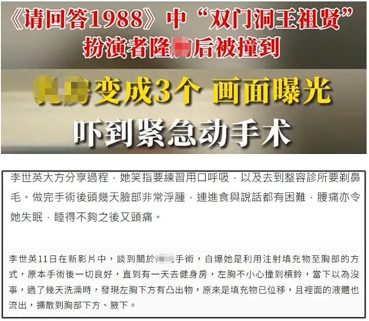 越来越多女星承认整容！有人后悔有人上瘾，动了28次手术停不下来（组图） - 20