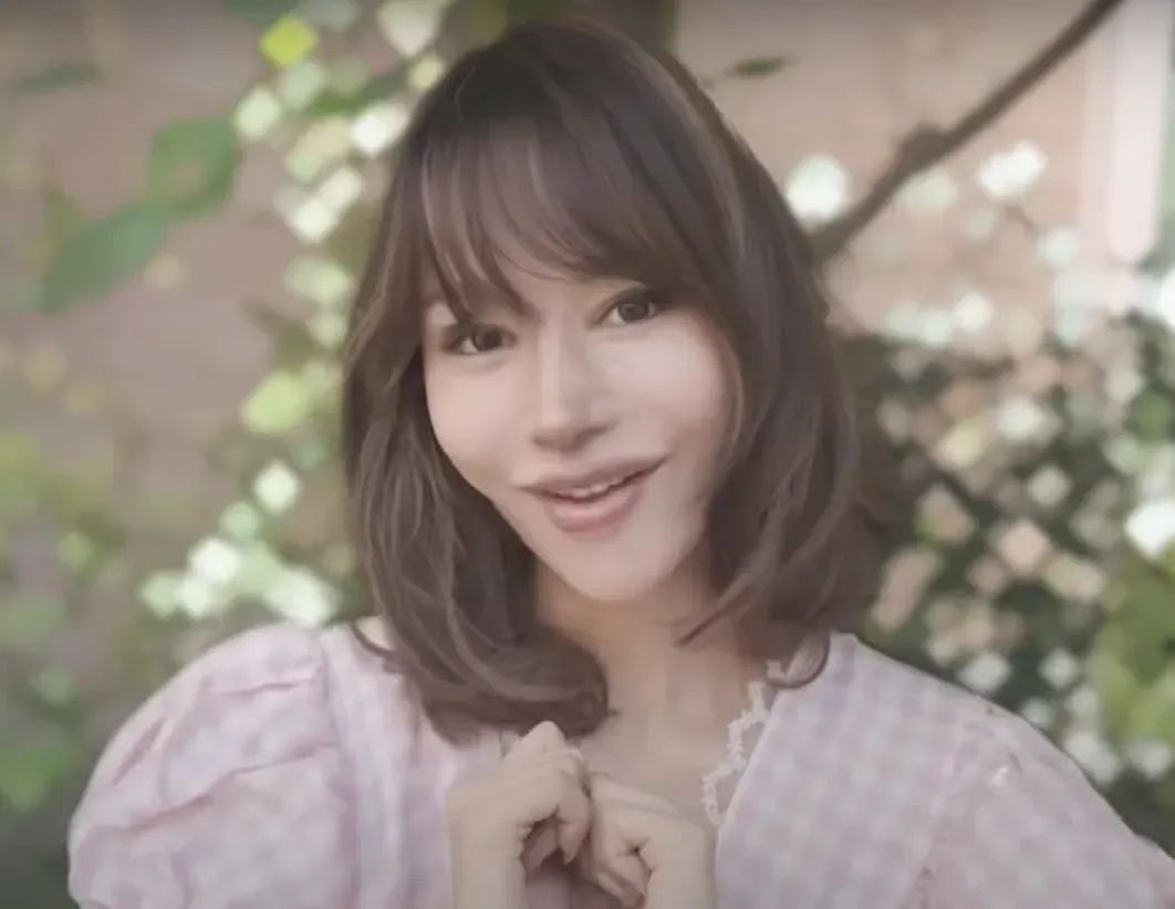 越来越多女星承认整容！有人后悔有人上瘾，动了28次手术停不下来（组图） - 15