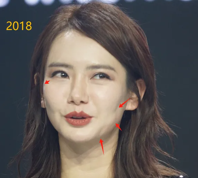 越来越多女星承认整容！有人后悔有人上瘾，动了28次手术停不下来（组图） - 23