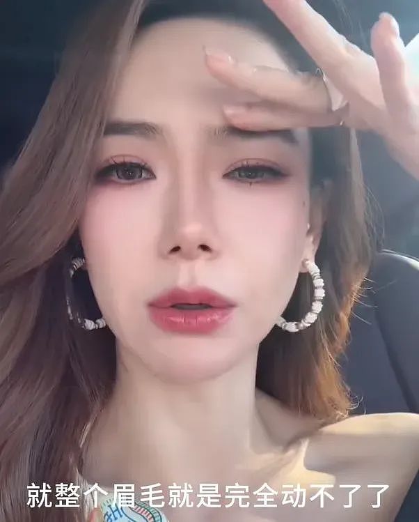 越来越多女星承认整容！有人后悔有人上瘾，动了28次手术停不下来（组图） - 1