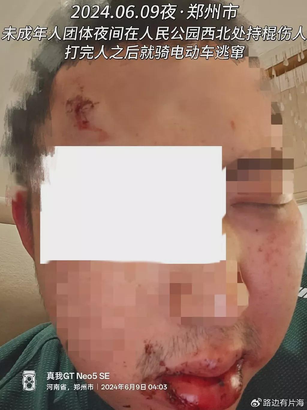 郑州围殴同性恋案:拉拉女卧底取证,却被拘留至今(组图) - 1