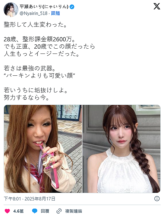砸钱翻转人生！日女模公开整形“前后对比”（图） - 2
