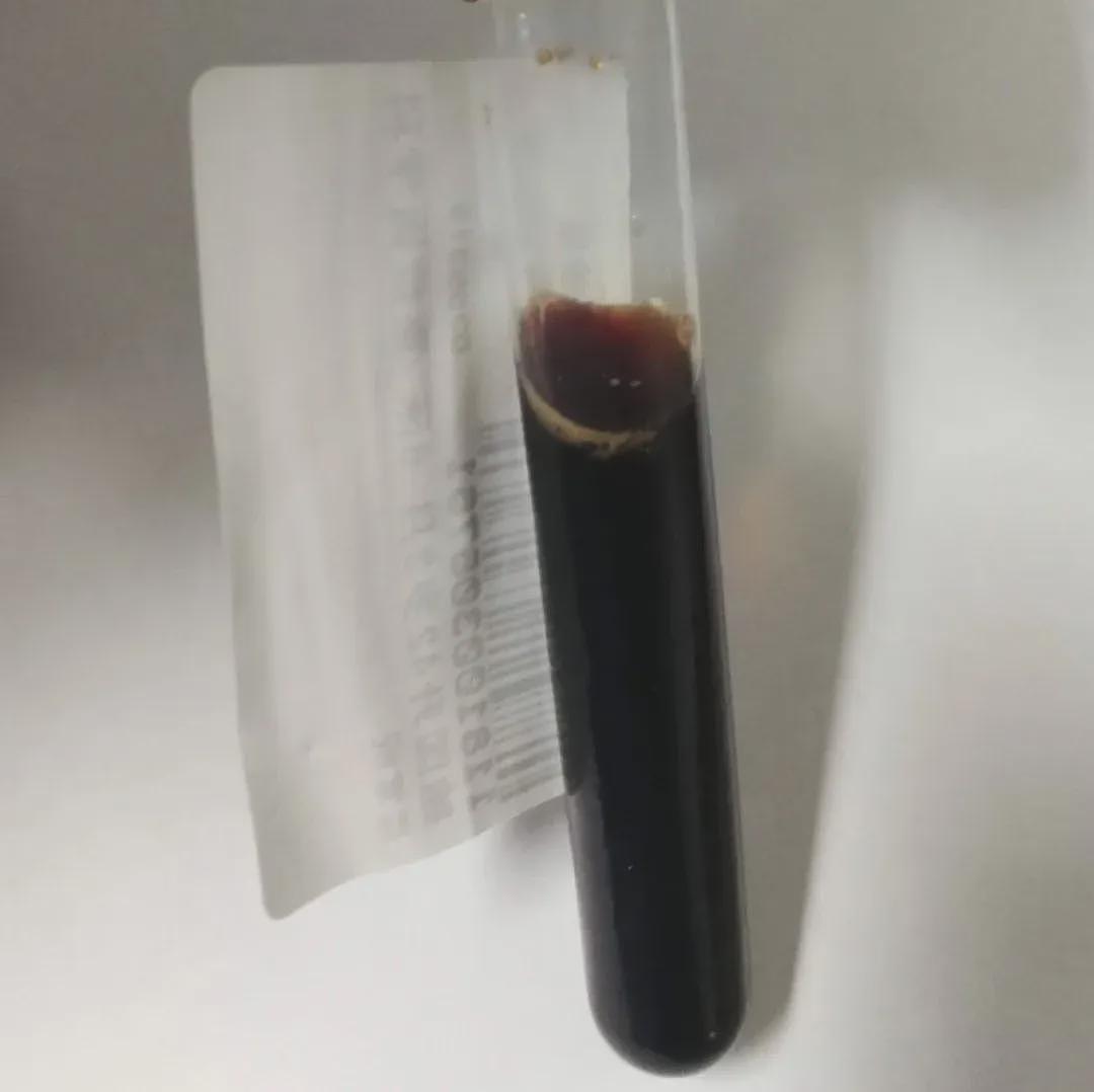 用力过猛！上海34岁男子尿出“酱油“，送医急救！医生：切不可硬抗（组图） - 2