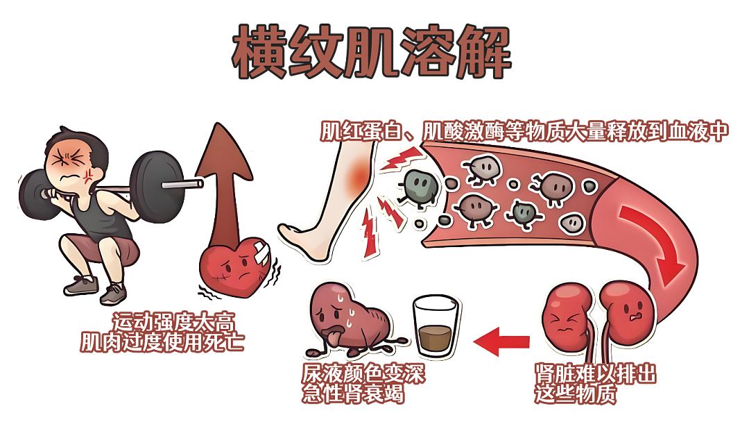 用力过猛！上海34岁男子尿出“酱油“，送医急救！医生：切不可硬抗（组图） - 3