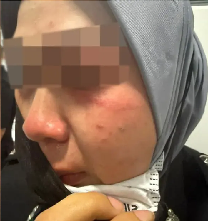 中国女子带娃大闹海关!辱骂暴打移民官致其脑震荡,法院判决引爆舆论...(组图) - 3