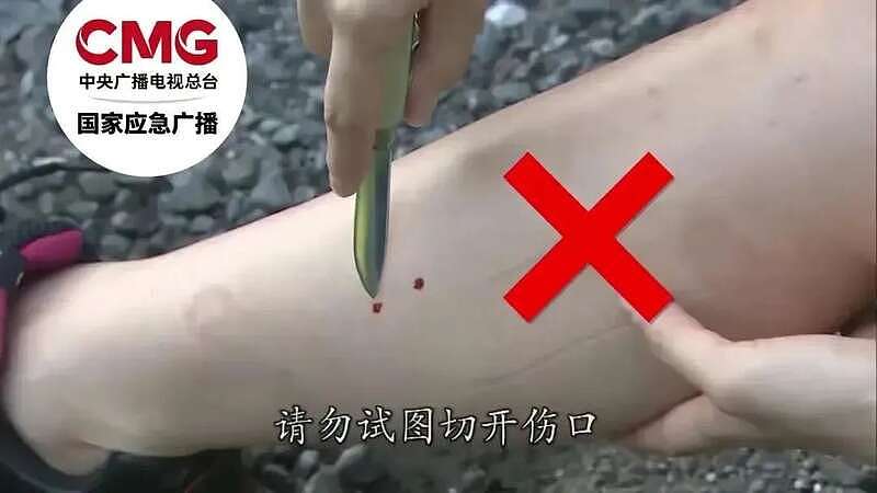 男子误踩打架中的竹叶青和五步蛇,被2蛇咬伤(组图) - 7