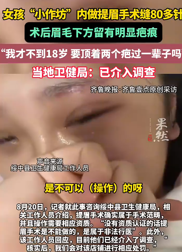 女孩理发店做提眉手术,被缝80多针留下明显疤痕(图) - 1