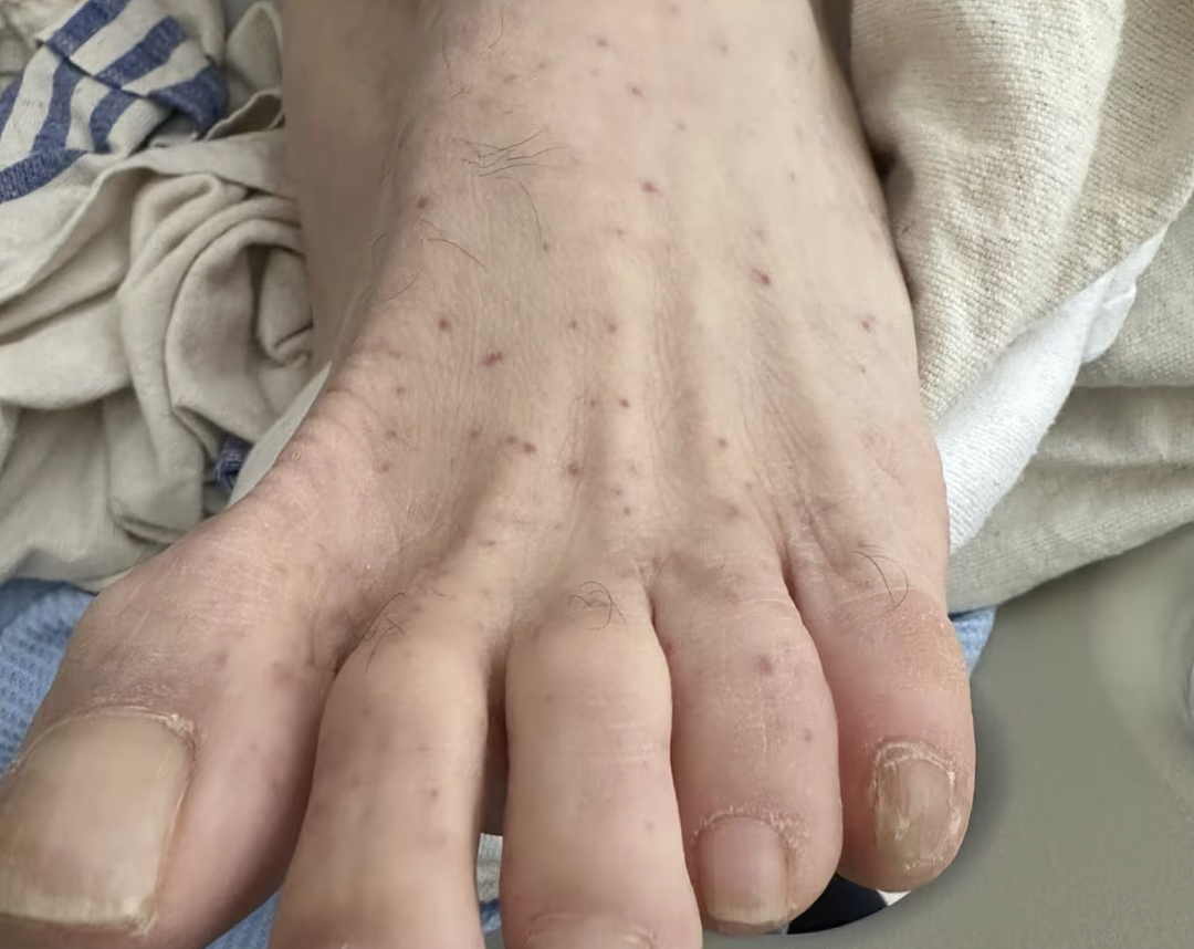 加拿大爆致命传染病,确诊首例感染!高烧呕吐、人宠双双中招!本地恐已扩散(组图) - 4