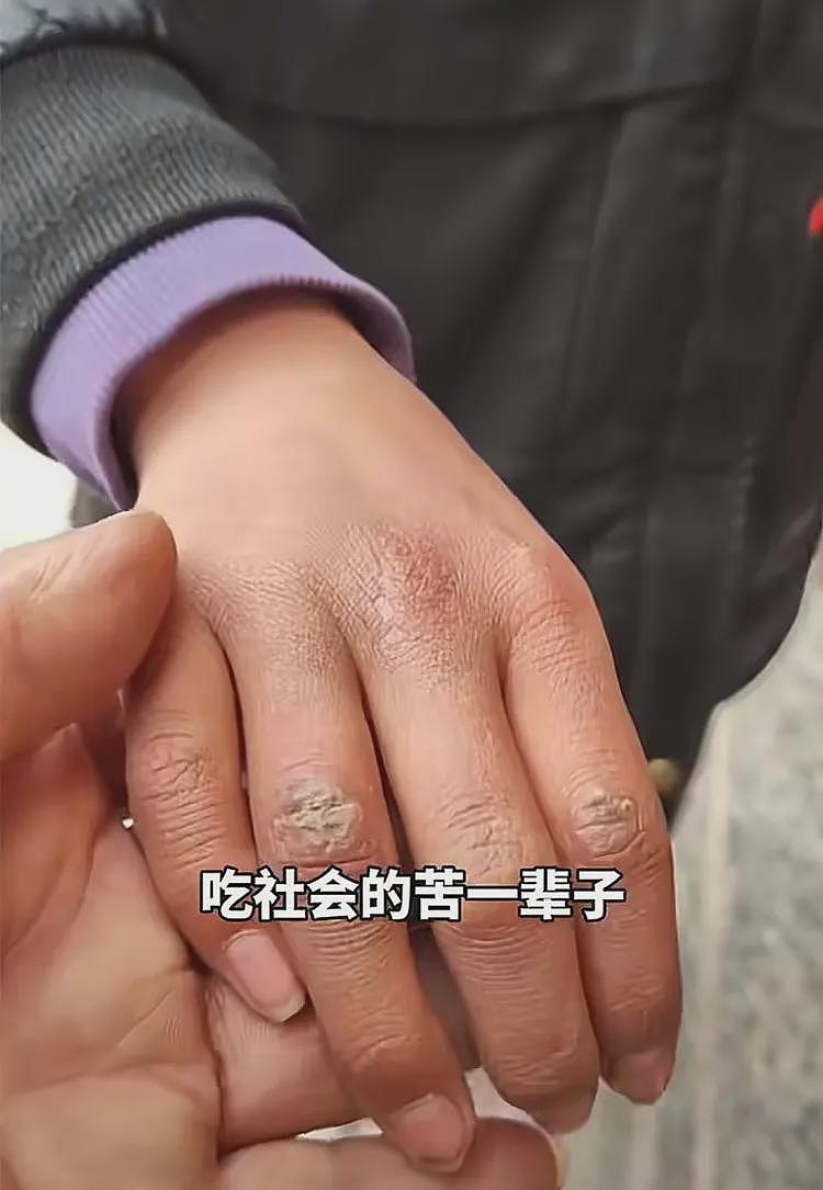 胡雷资助感动全网的女孩去世，和家人争执后自杀，遗体在水池发现（组图） - 9